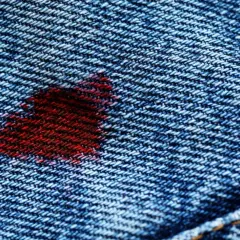 Ein roter Fleck auf blauer Jeans. Ein kleiner Unfall, aber mit den richtigen Mitteln lässt sich Blut aus Jeans entfernen.